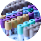 Serum Specifc IgE Test