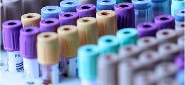 Supportive IgE Tests